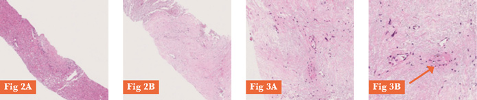 Fig2 e 3