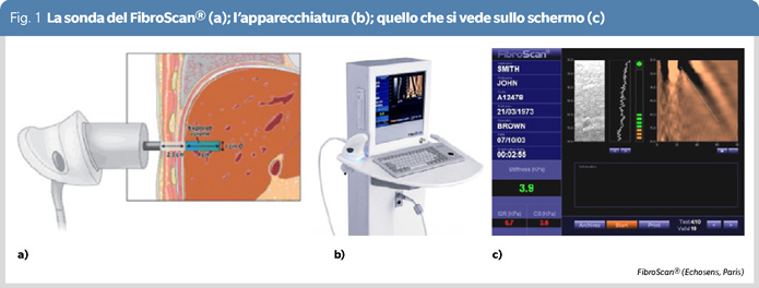 fig1